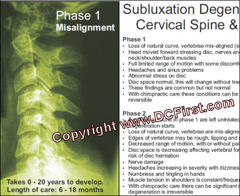 Subluxation Degeneration Poster