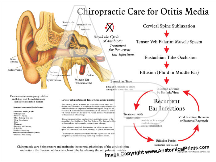Chiropractic Care for Otitis Media Poster