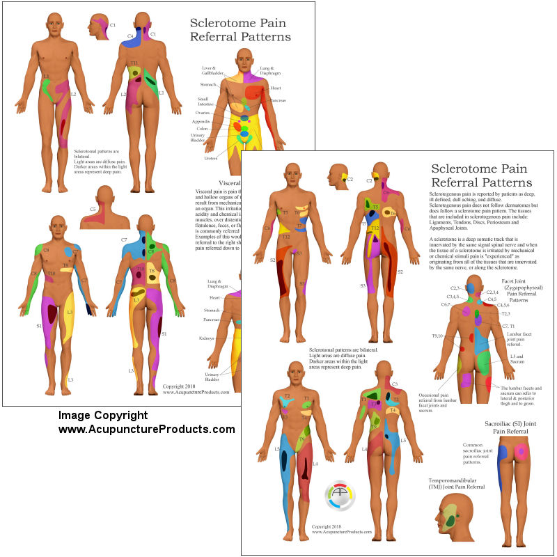 si joint pain referral patterns