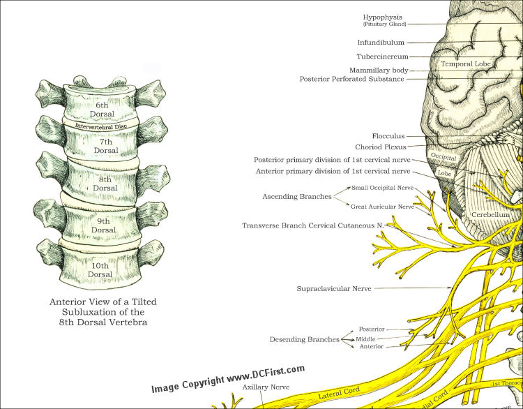 Spinal Nerves Subluxations Poster